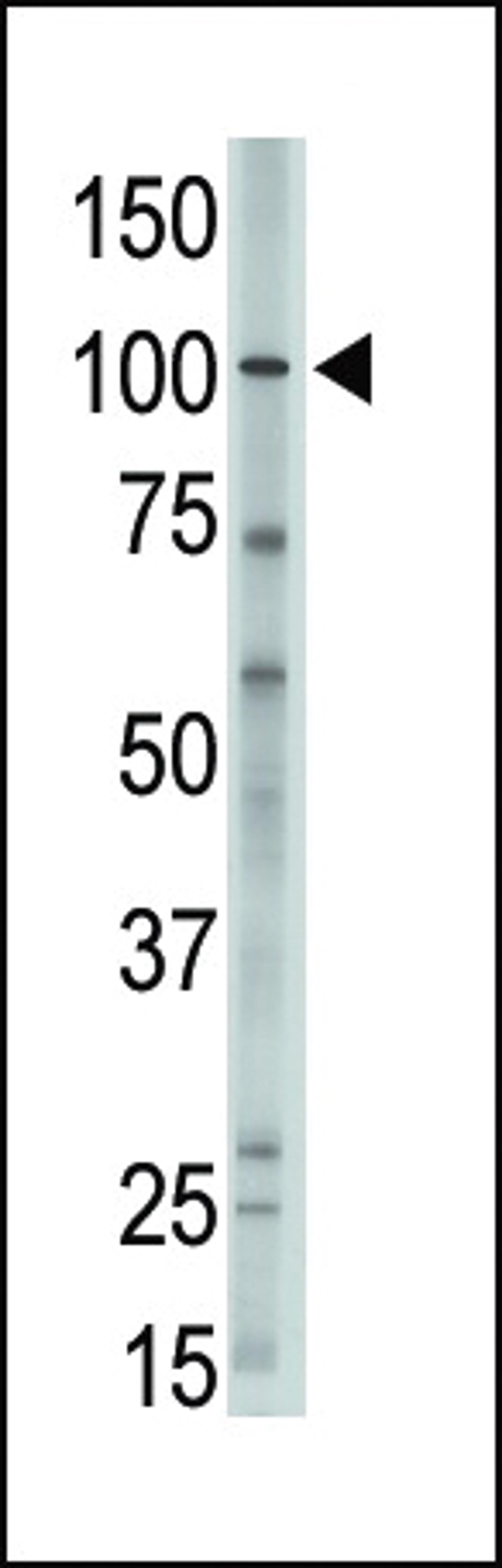 Antibody is used in Western blot to detect MVP in A375 lysate.