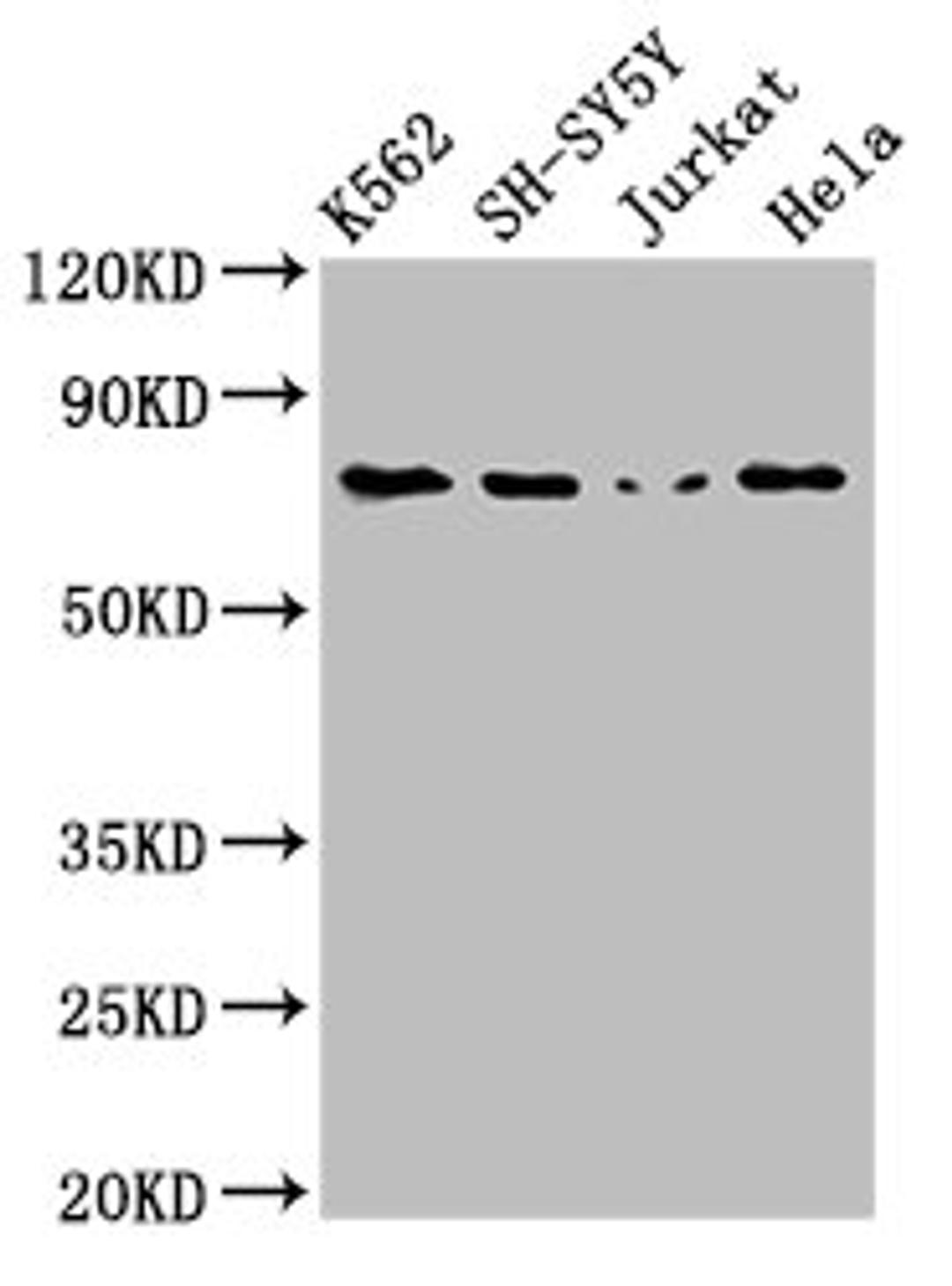 Western Blot. Positive WB detected in: K562 whole cell lysate, SH-SY5Y whole cell lysate, Jurkat whole cell lysate, Hela whole cell lysate. All lanes: PRKCB antibody at 3ug/ml. Secondary. Goat polyclonal to rabbit IgG at 1/50000 dilution. Predicted band size: 77, 78 kDa. Observed band size: 77 kDa. 