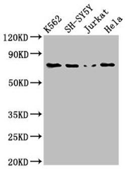 Western Blot. Positive WB detected in: K562 whole cell lysate, SH-SY5Y whole cell lysate, Jurkat whole cell lysate, Hela whole cell lysate. All lanes: PRKCB antibody at 3ug/ml. Secondary. Goat polyclonal to rabbit IgG at 1/50000 dilution. Predicted band size: 77, 78 kDa. Observed band size: 77 kDa. 