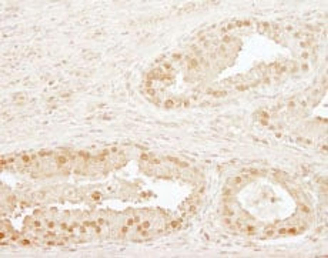 Detection of human CPSF73 by immunohistochemistry.