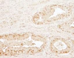 Detection of human CPSF73 by immunohistochemistry.