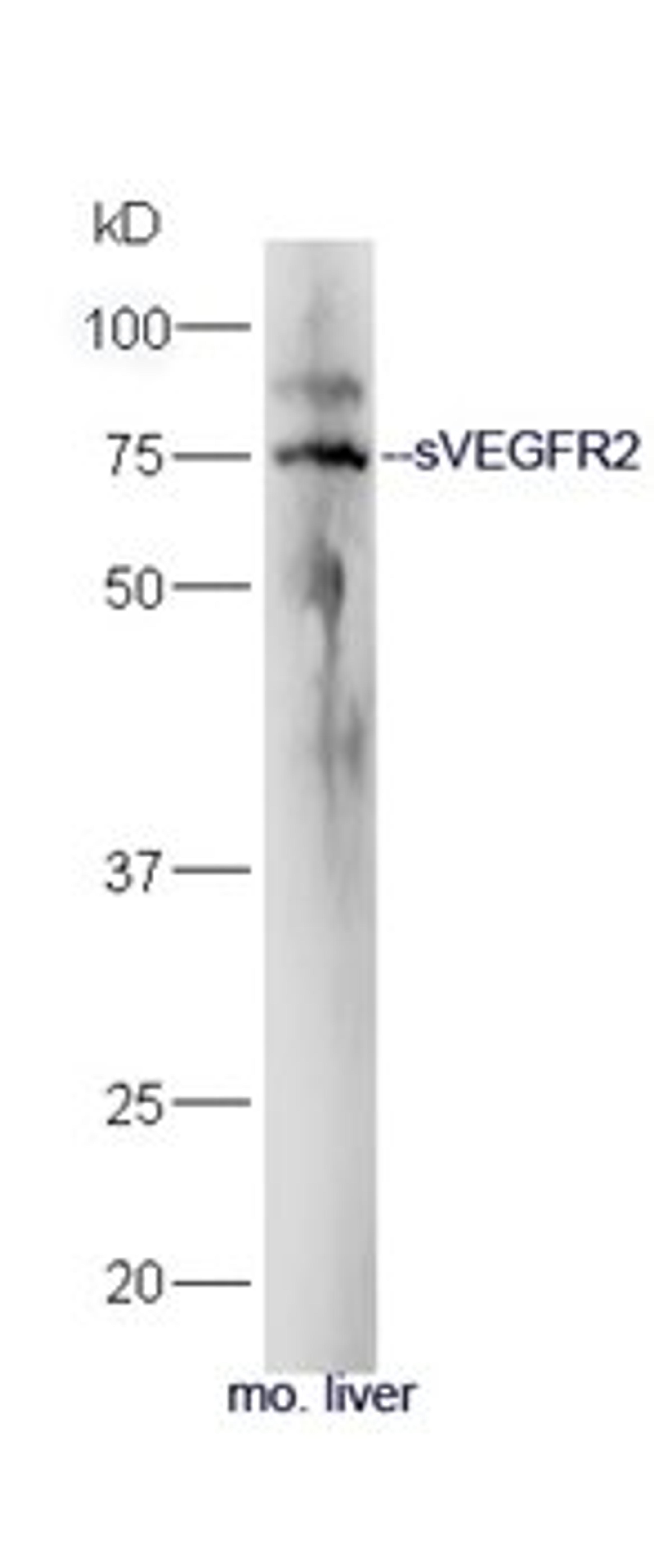   Western blot analysis of mouse liver lysate using sVEGFR2 antibody (primary antibody dilution at 1:300)