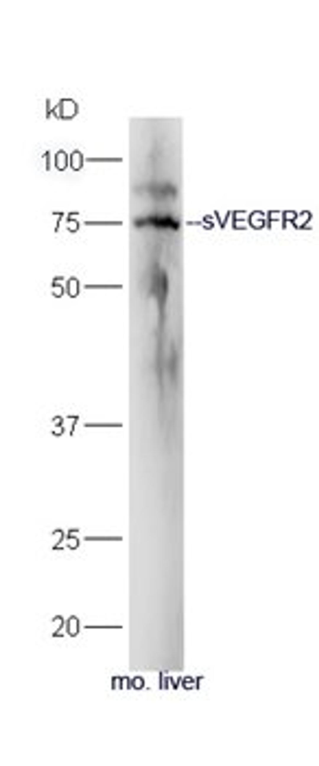 Western blot analysis of mouse liver lysate using sVEGFR2 antibody (primary antibody dilution at 1:300)