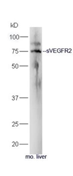 Western blot analysis of mouse liver lysate using sVEGFR2 antibody (primary antibody dilution at 1:300)