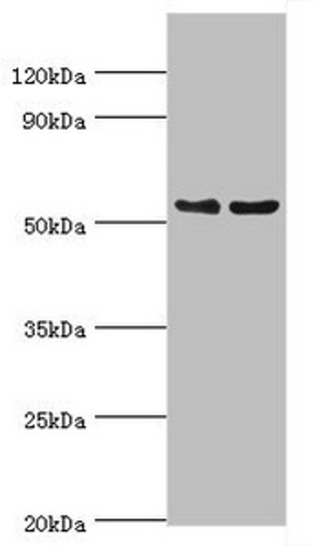 Western blot. All lanes: Transcription factor EB antibody at 3ug/ml. Lane 1: Jurkat whole cell lysate. Lane 2: Mouse brain tissue. Secondary. Goat polyclonal to rabbit IgG at 1/10000 dilution. Predicted band size: 53, 44 kDa. Observed band size: 53 kDa. 