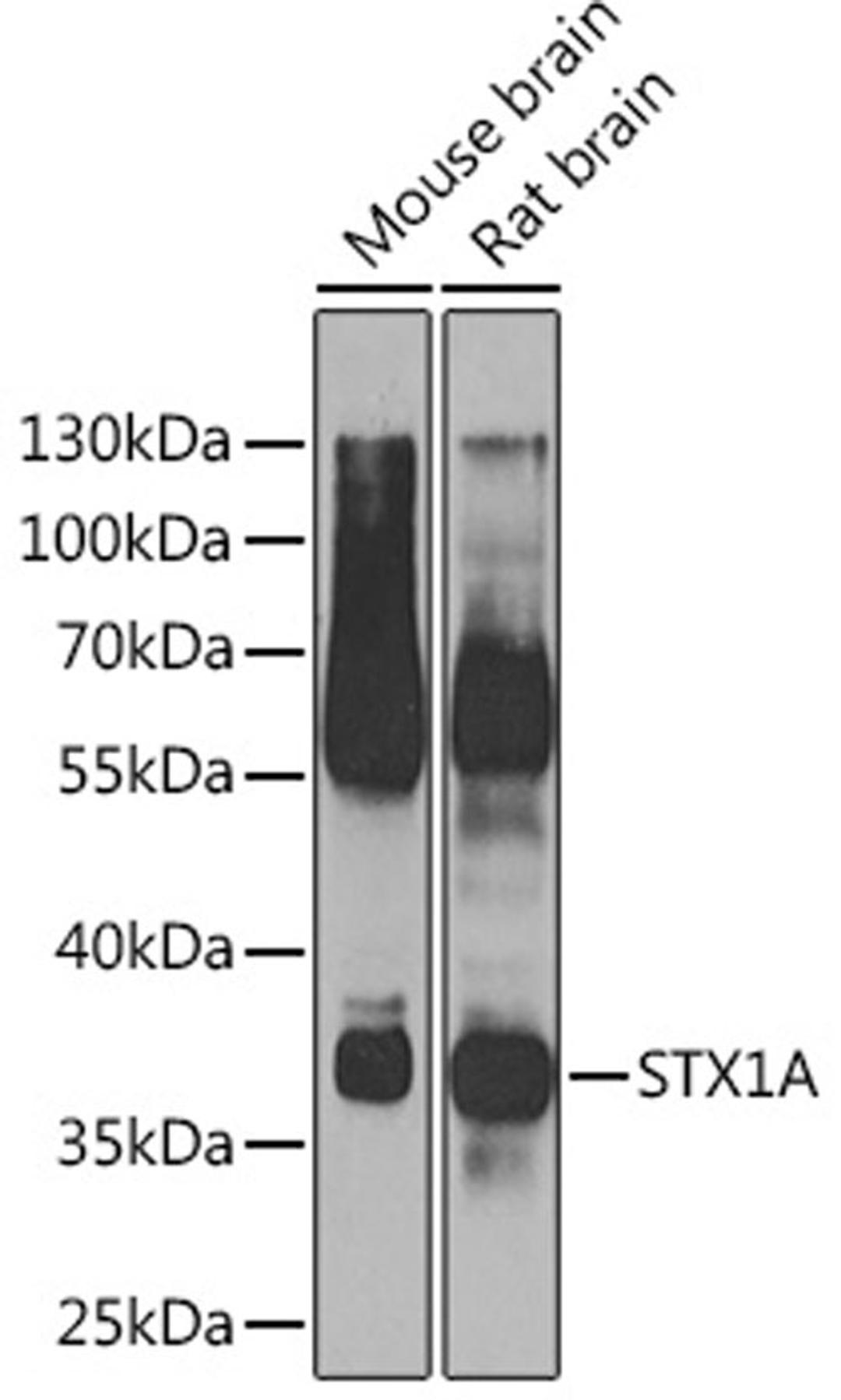 Western blot - STX1A Rabbit pAb (A7931)