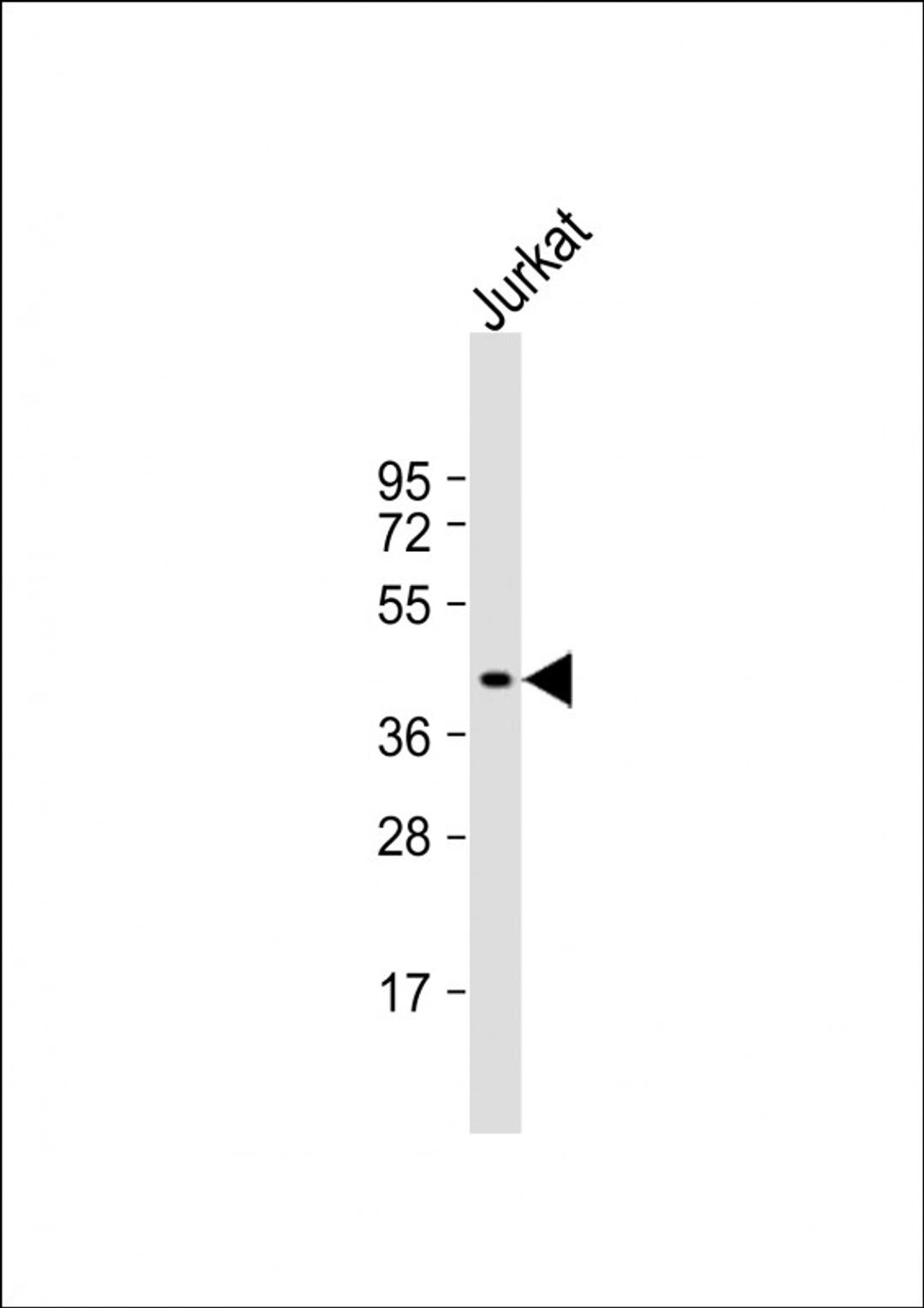 Western Blot at 1:1000 dilution + Jurkat whole cell lysate Lysates/proteins at 20 ug per lane.