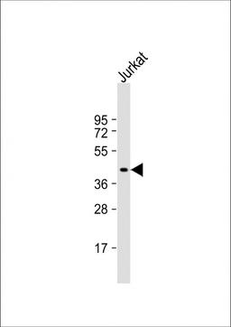 Western Blot at 1:1000 dilution + Jurkat whole cell lysate Lysates/proteins at 20 ug per lane.