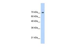 Antibody used in WB on Recombinant STAT1 protein at 5 ug/ml.