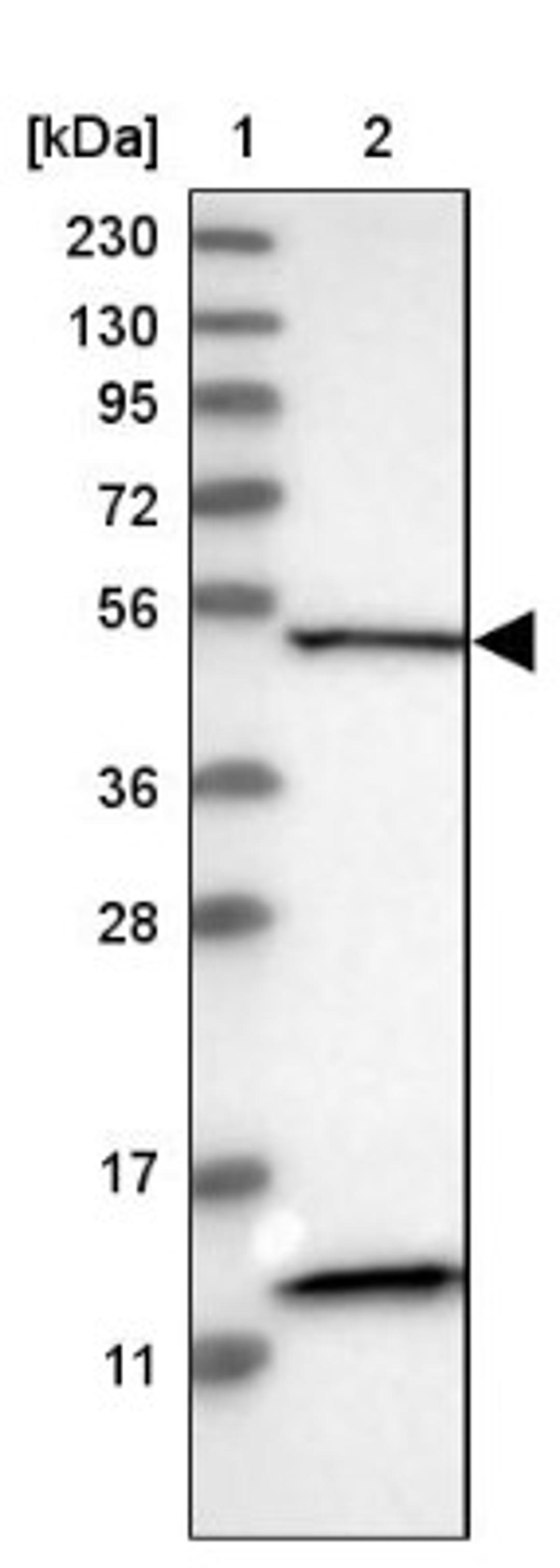 Western Blot: SETD4 Antibody [NBP1-88279] - Lane 1: Marker [kDa] 230, 130, 95, 72, 56, 36, 28, 17, 11<br/>Lane 2: Human cell line RT-4