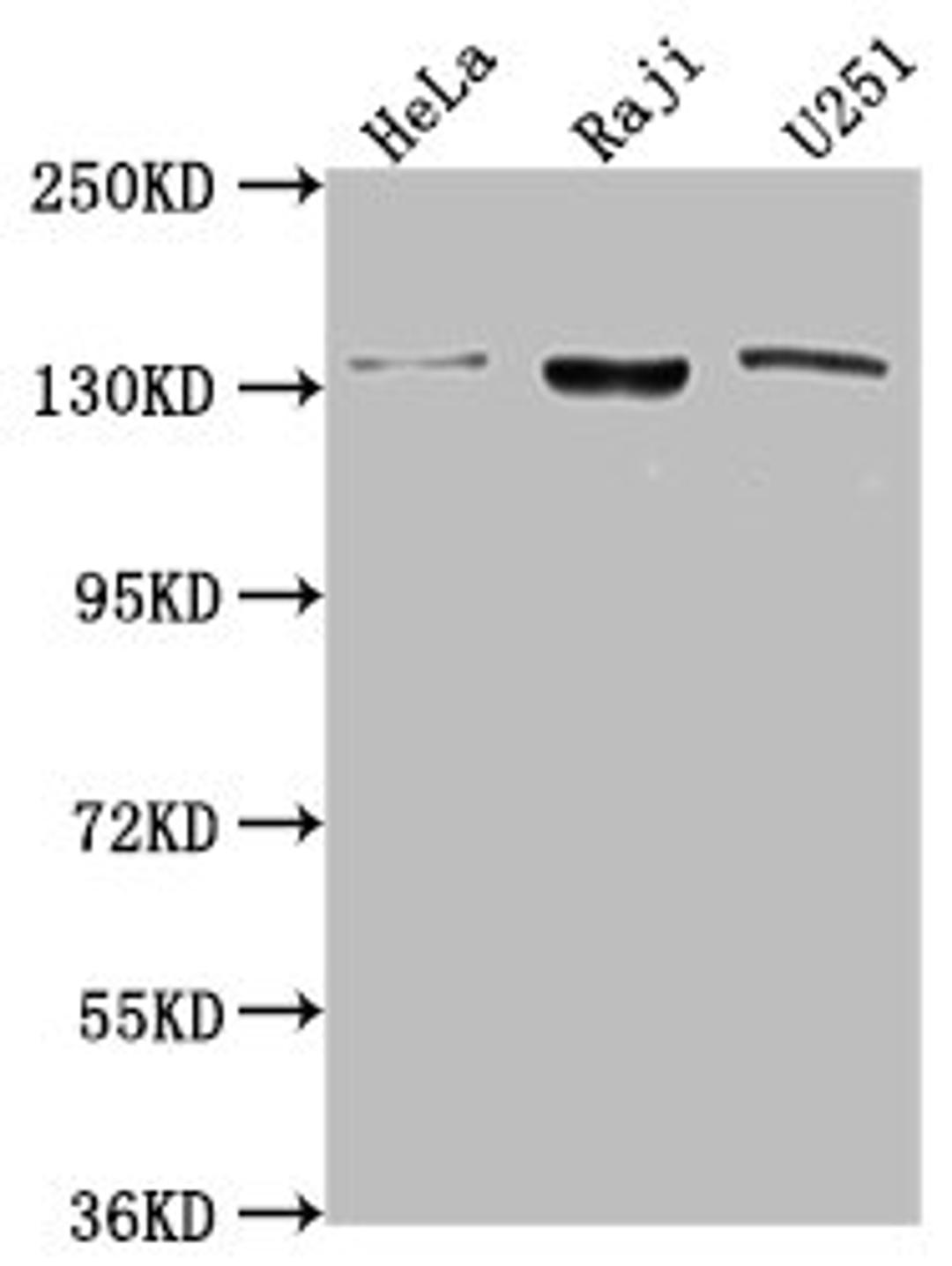Western Blot. Positive WB detected in: Hela whole cell lysate, Raji whole cell lysate, U251 whole cell lysate. All lanes: LARS antibody at 1:2000. Secondary. Goat polyclonal to rabbit IgG at 1/50000 dilution. Predicted band size: 135, 129, 56 kDa. Observed band size: 135 kDa. 
