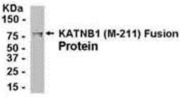 E coli-derived fusion protein as test antigen. Affinity-purified IgY dilution: 1:2000, Goat anti-IgY-HRP dilution: 1:1000. Colorimetric method for signal development.