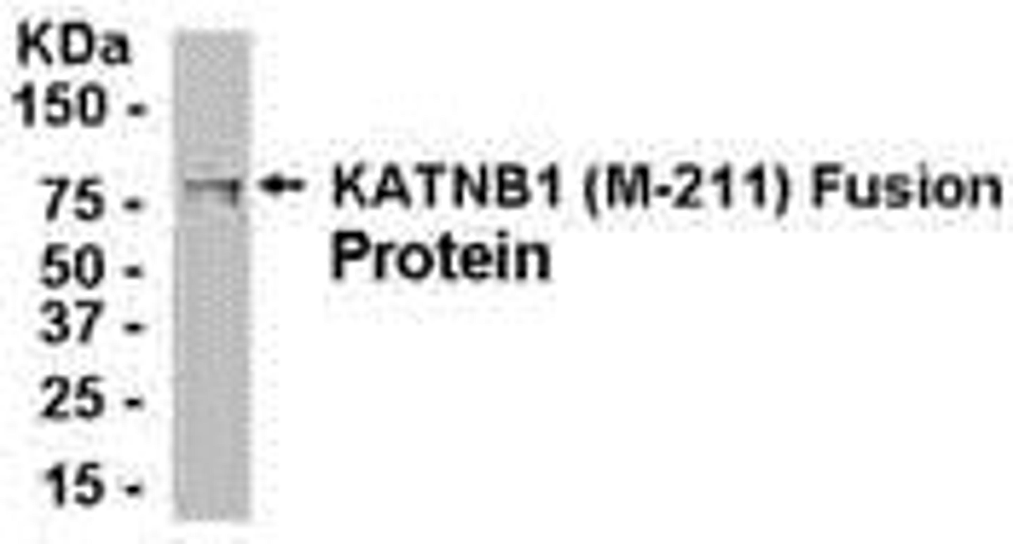 E coli-derived fusion protein as test antigen. Affinity-purified IgY dilution: 1:2000, Goat anti-IgY-HRP dilution: 1:1000. Colorimetric method for signal development.