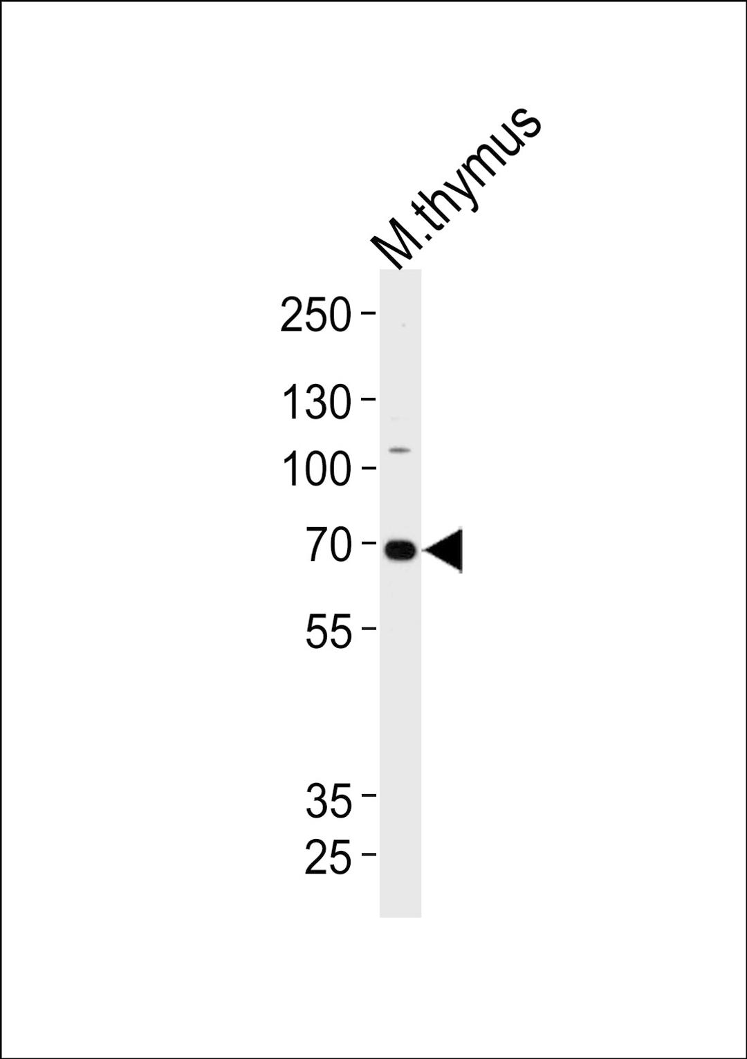 Western blot analysis of lysate from mouse thymus tissue lysate, using Mouse Ephb6 Antibody at 1:1000 at each lane.