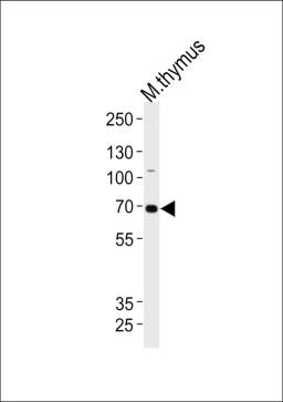 Western blot analysis of lysate from mouse thymus tissue lysate, using Mouse Ephb6 Antibody at 1:1000 at each lane.