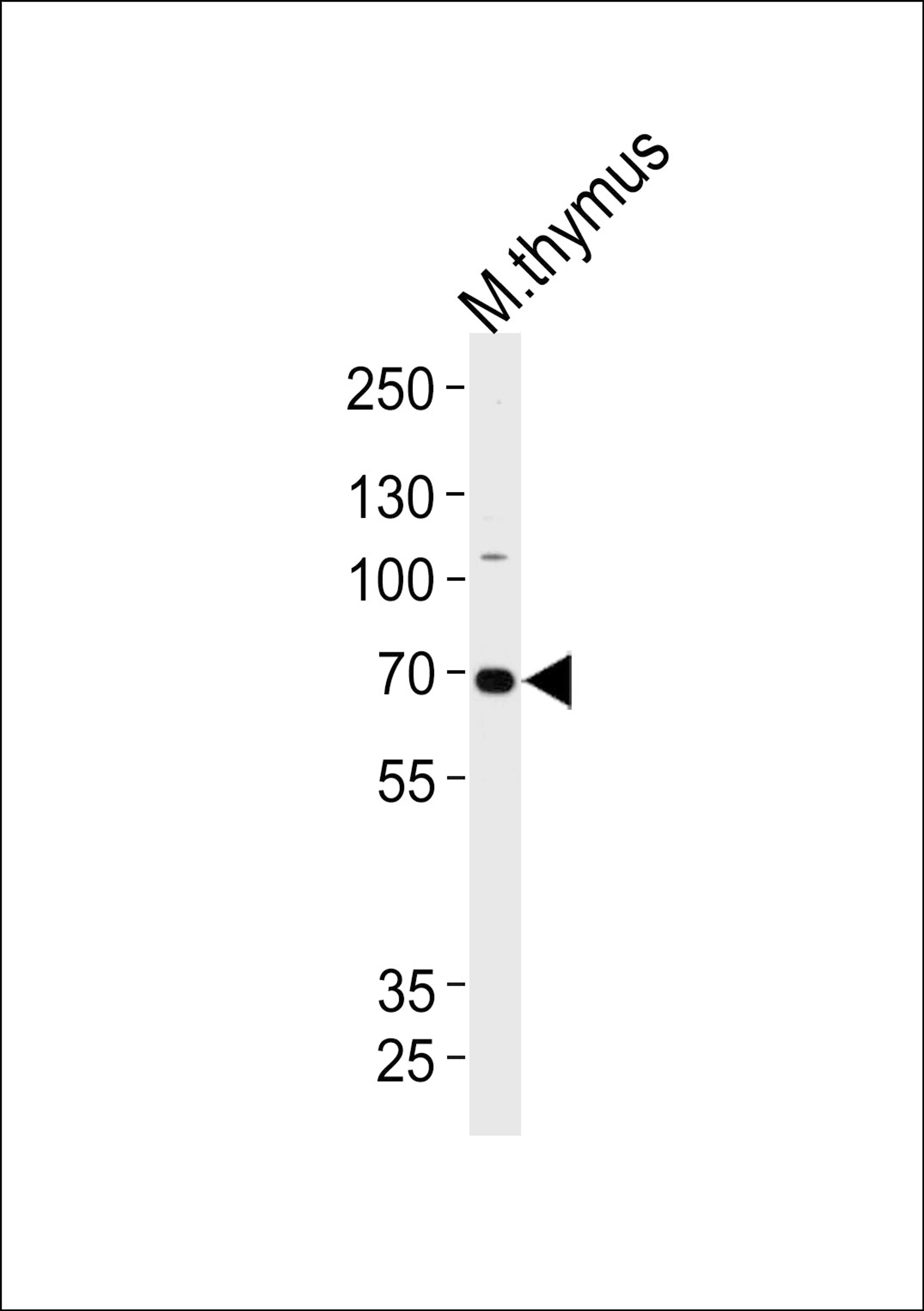 Western blot analysis of lysate from mouse thymus tissue lysate, using Mouse Ephb6 Antibody at 1:1000 at each lane.