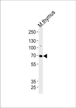 Western blot analysis of lysate from mouse thymus tissue lysate, using Mouse Ephb6 Antibody at 1:1000 at each lane.