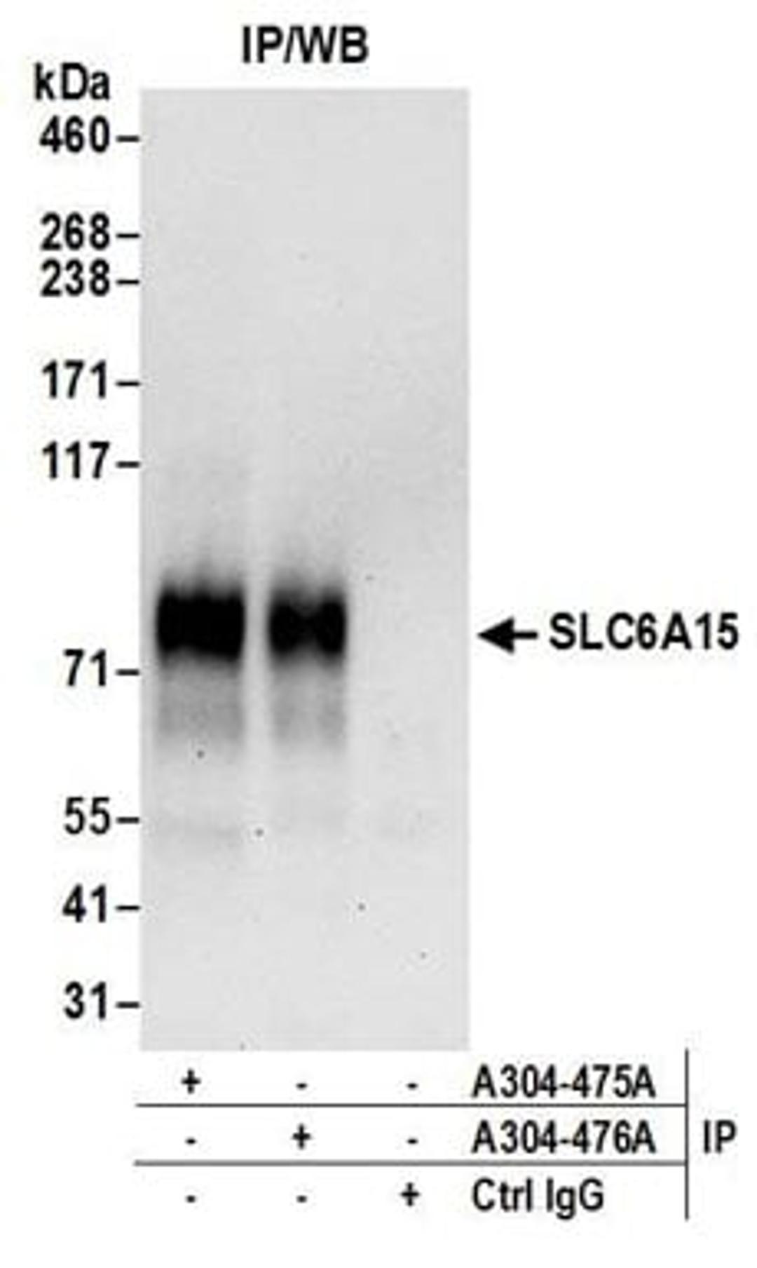 Detection of human SLC6A15 by western blot of immunoprecipitates.