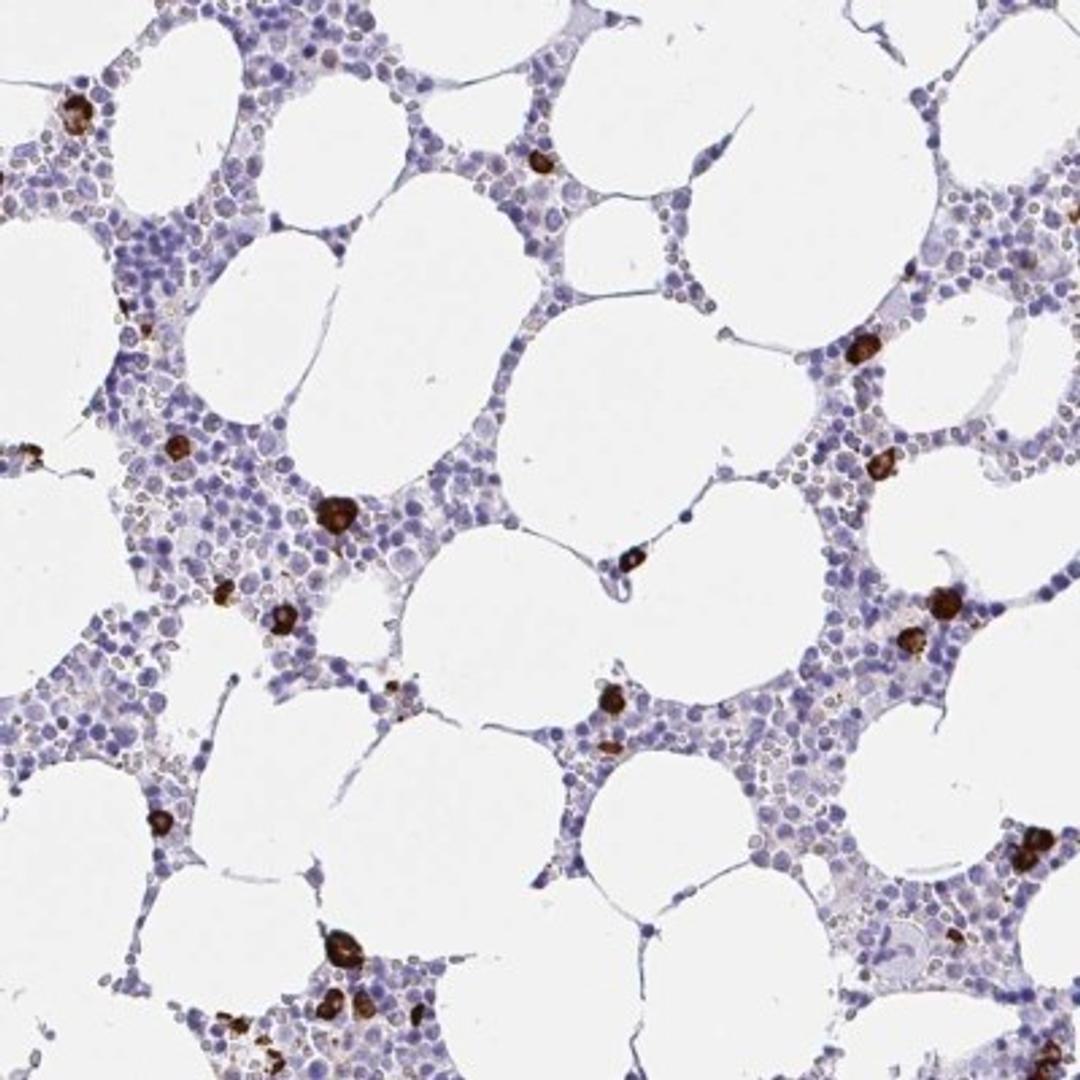 Immunohistochemistry: CCDC62 Antibody [NBP2-32398] - Staining of human bone marrow shows strong cytoplasmic positivity in hematopoietic cells.