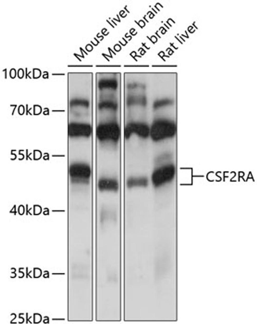 Western blot - CSF2RA antibody (A13181)