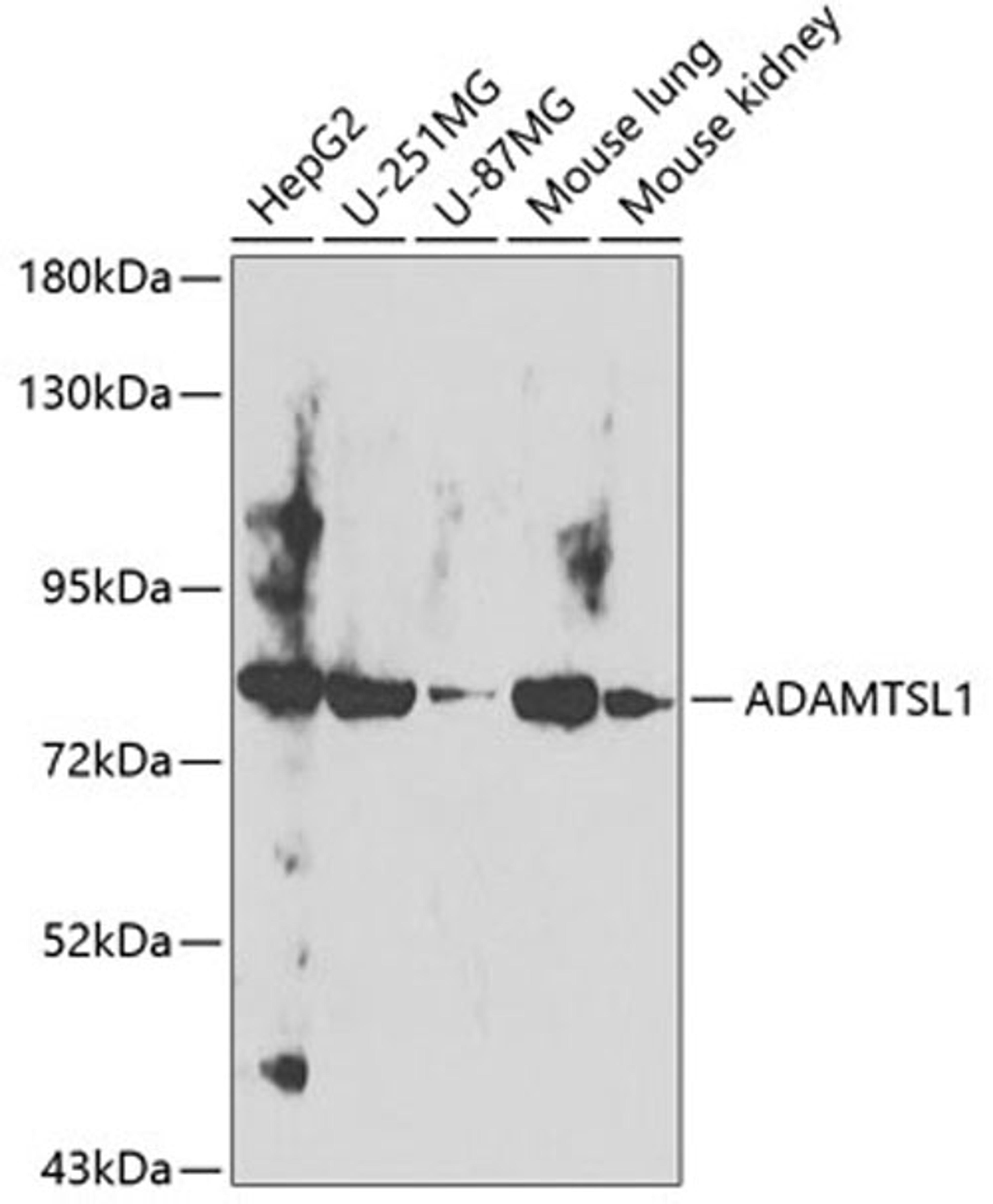 Western blot - ADAMTSL1 antibody (A8073)