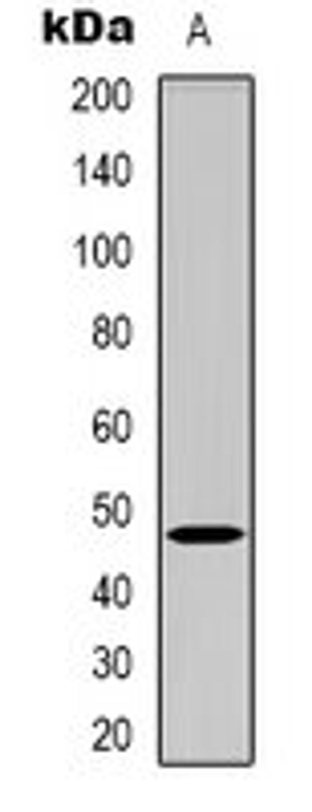 Western blot analysis of Hela (Lane 1) whole cell lysates using GDF7 antibody