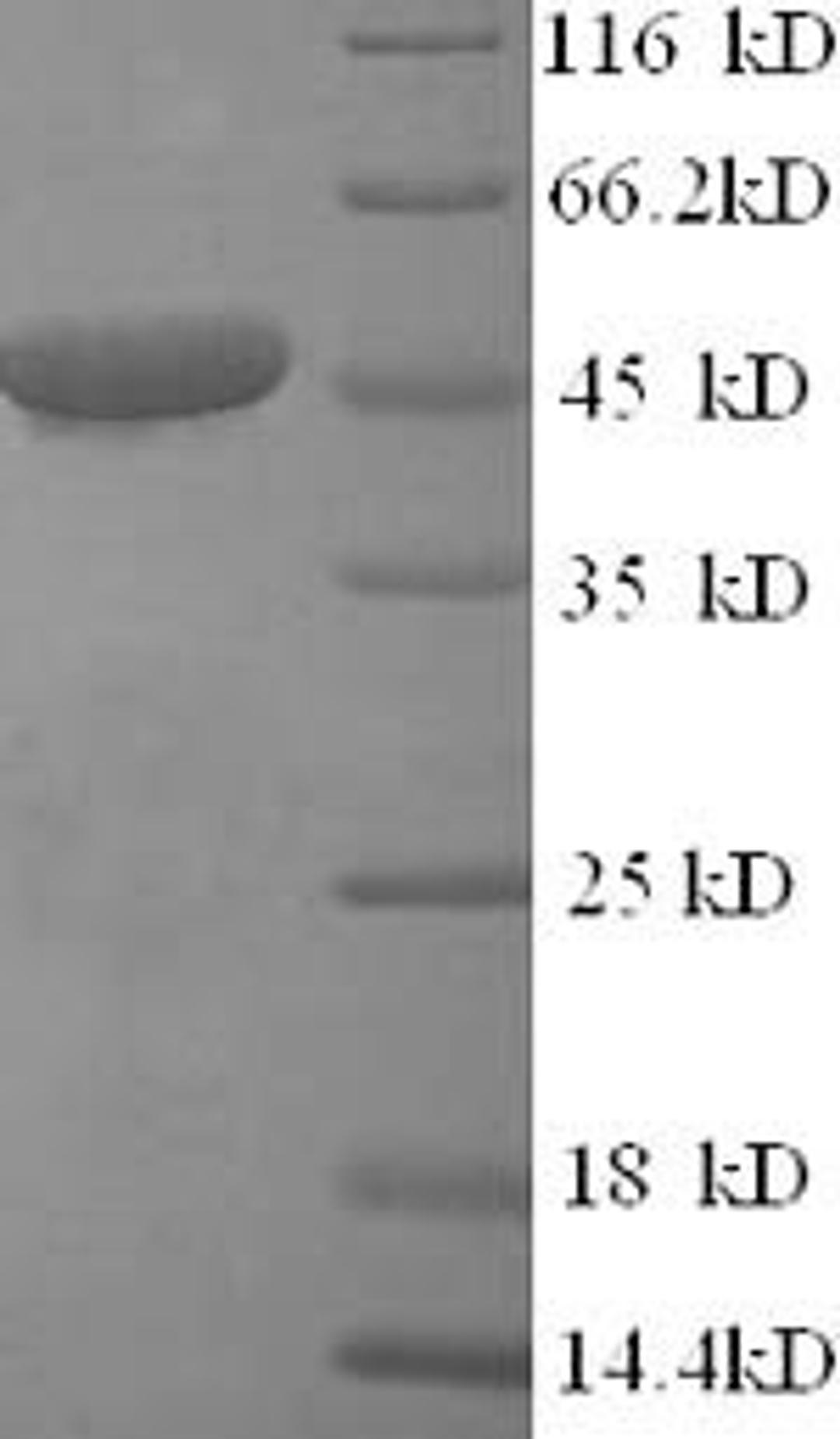 (Tris-Glycine gel) Discontinuous SDS-PAGE (reduced) with 5% enrichment gel and 15% separation gel.