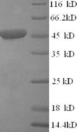 (Tris-Glycine gel) Discontinuous SDS-PAGE (reduced) with 5% enrichment gel and 15% separation gel.