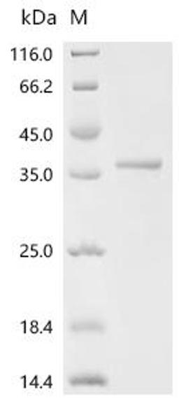 (Tris-Glycine gel) Discontinuous SDS-PAGE (reduced) with 5% enrichment gel and 15% separation gel.