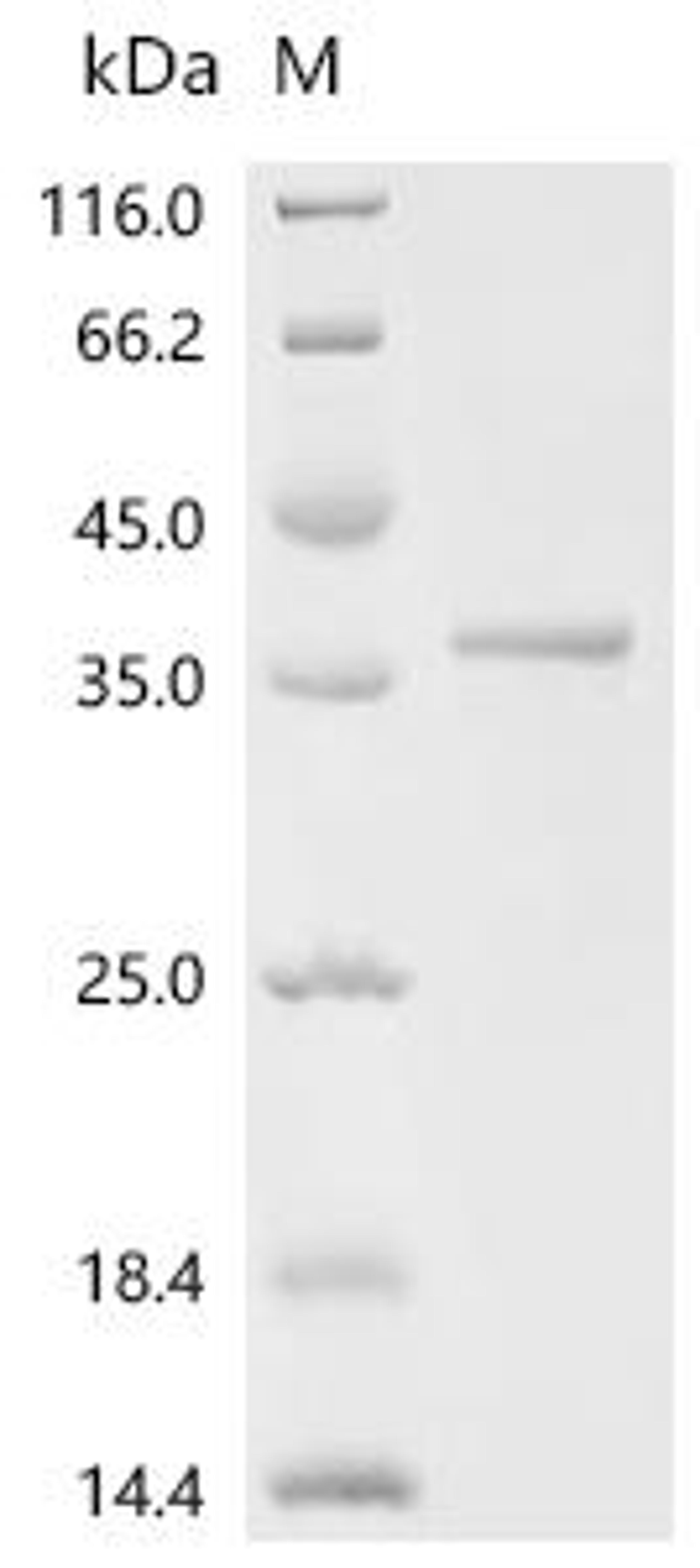 (Tris-Glycine gel) Discontinuous SDS-PAGE (reduced) with 5% enrichment gel and 15% separation gel.