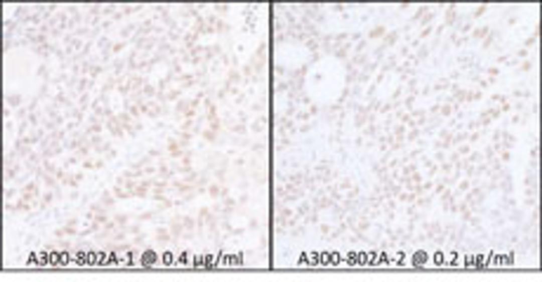 Detection of human SUPT6H by immunohistochemistry.