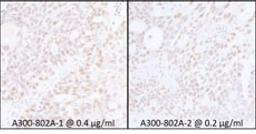 Detection of human SUPT6H by immunohistochemistry.