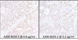 Detection of human SUPT6H by immunohistochemistry.