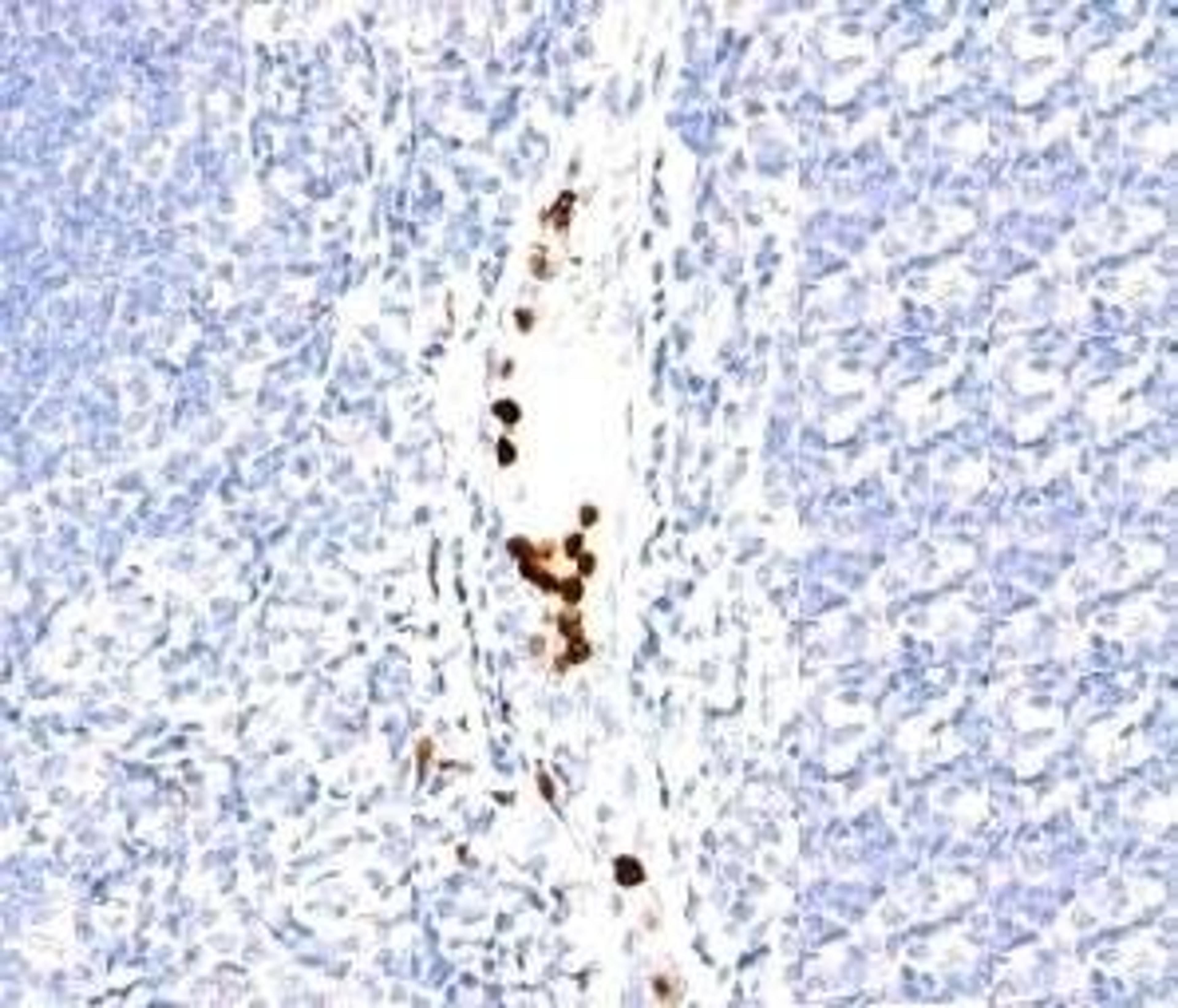 Immunohistochemical staining of Human tonsil using Granulocyte antibody