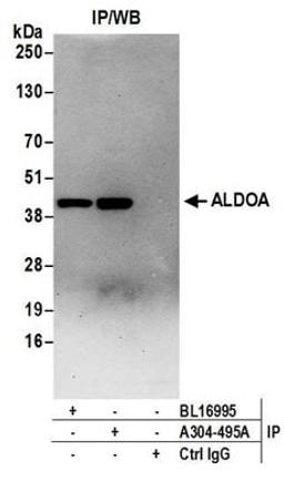 Detection of human ALDOA by western blot of immunoprecipitates.