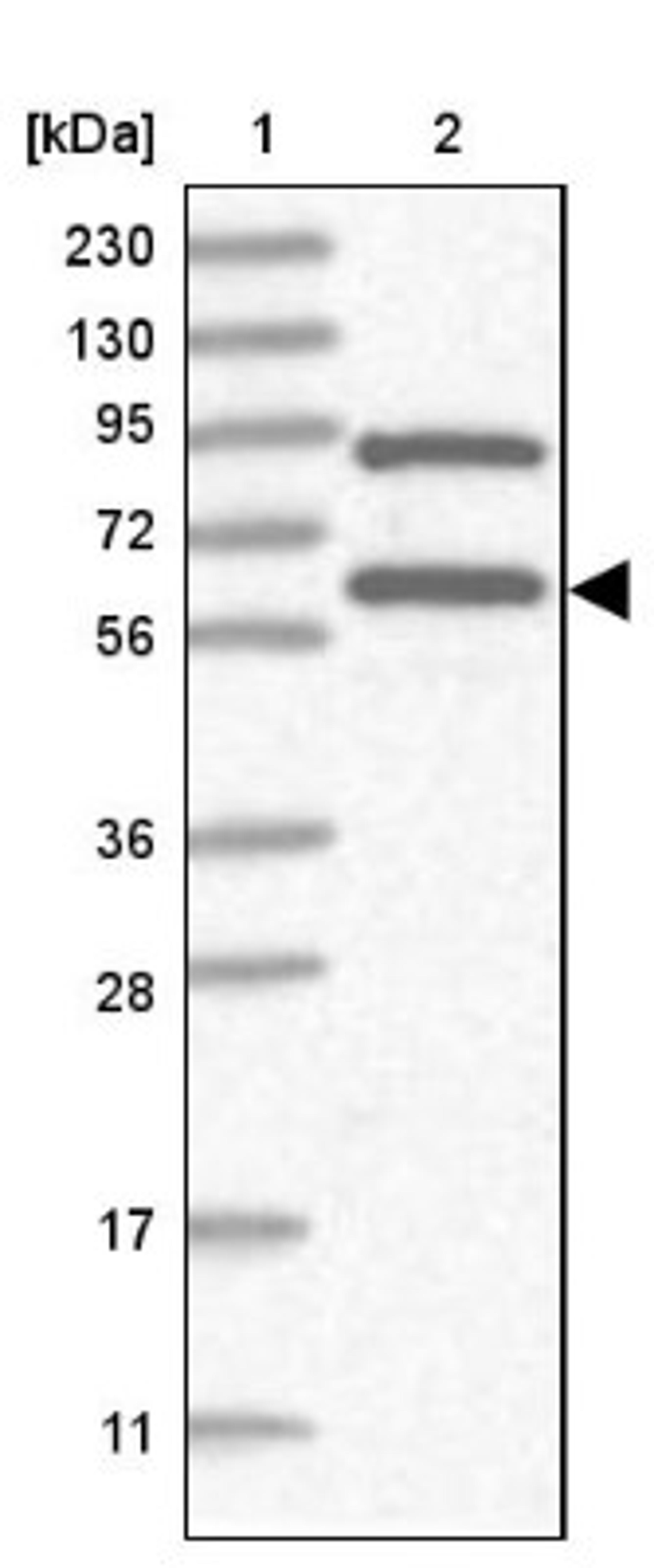 Western Blot: RNF25 Antibody [NBP2-32664] - Lane 1: Marker [kDa] 230, 130, 95, 72, 56, 36, 28, 17, 11<br/>Lane 2: Human cell line RT-4