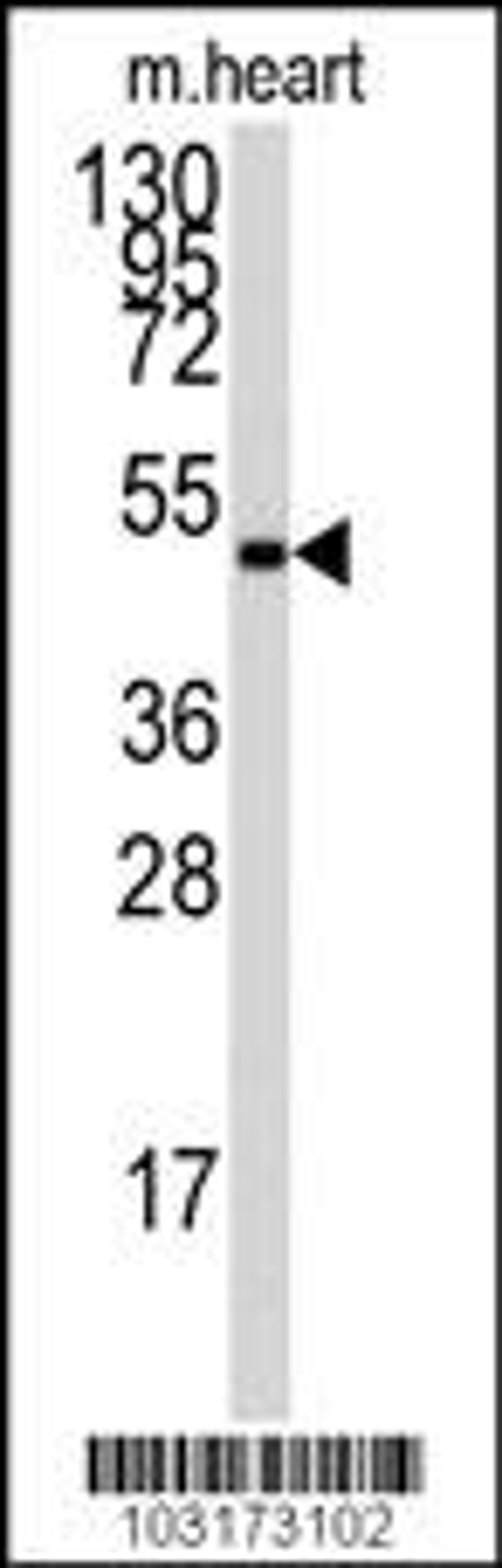 Antibody is used in Western blot to detect PRKAG1 in mouse heart tissue lysate.