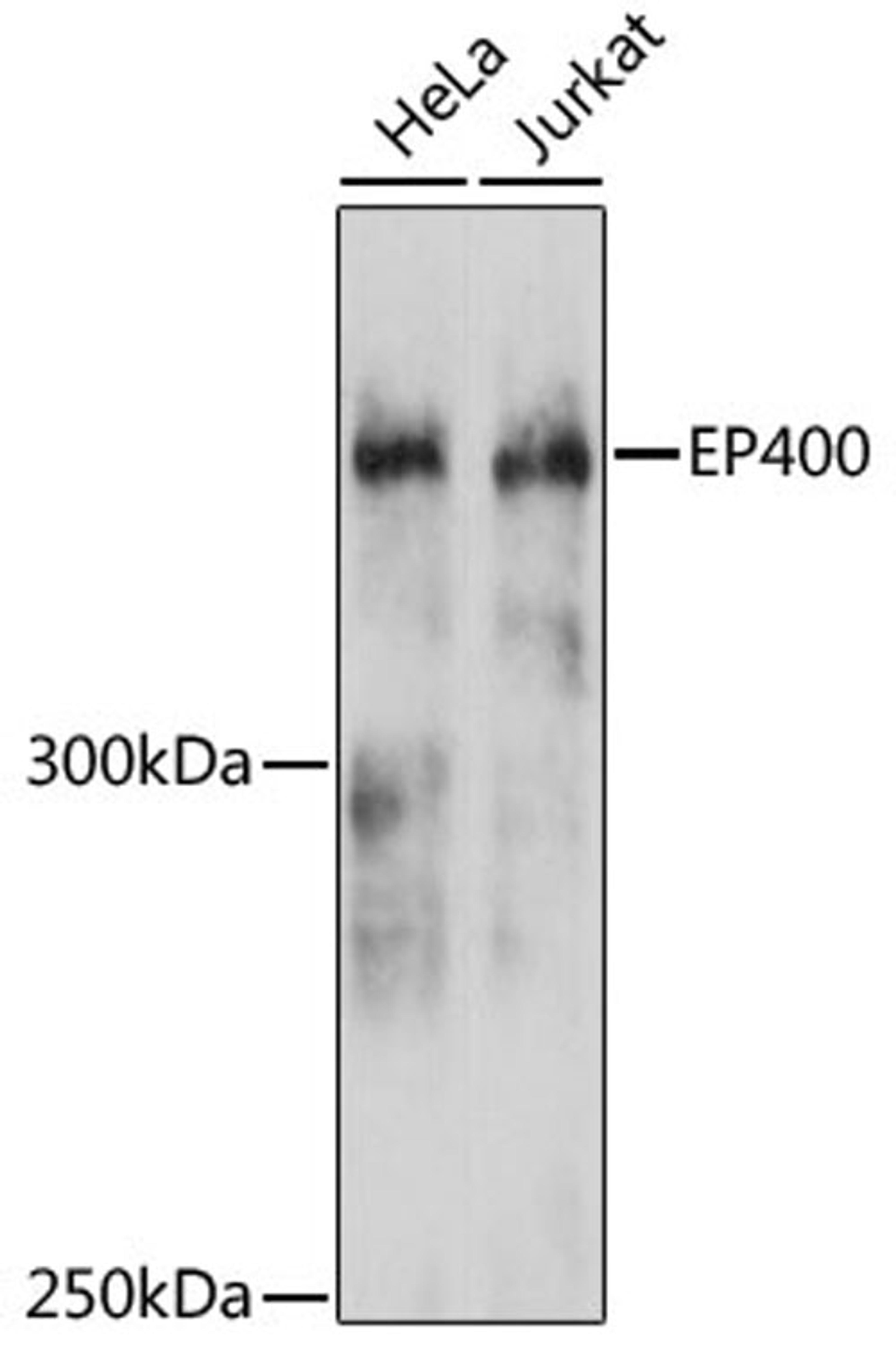 Western blot - EP400 antibody (A12151)