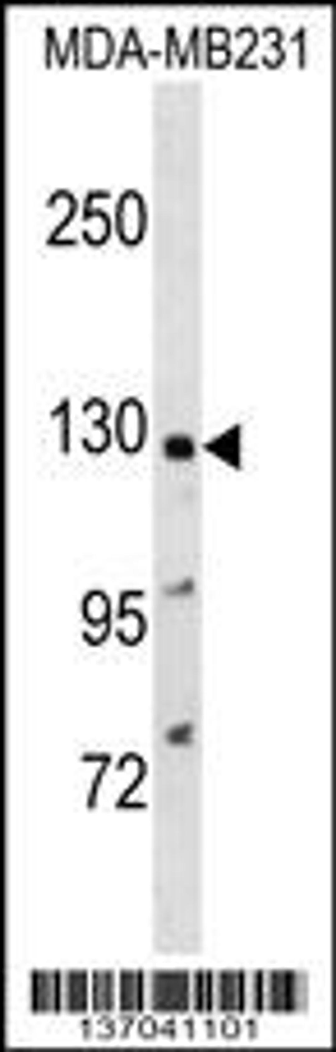 Western blot analysis in MDA-MB231 cell line lysates (35ug/lane).