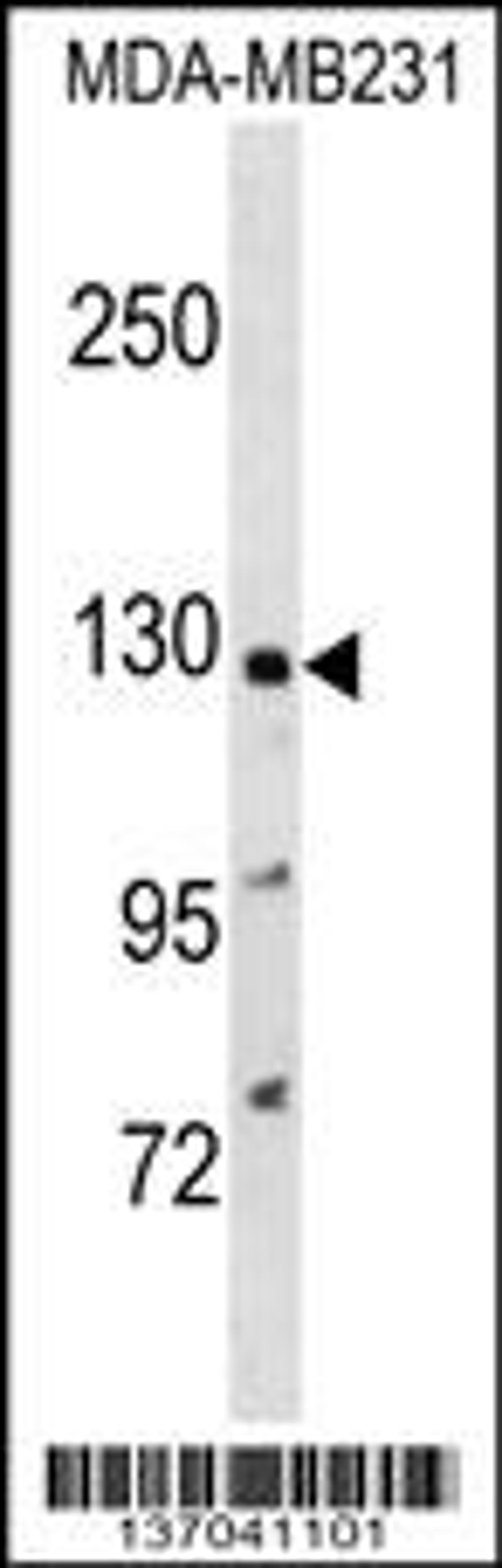 Western blot analysis in MDA-MB231 cell line lysates (35ug/lane).