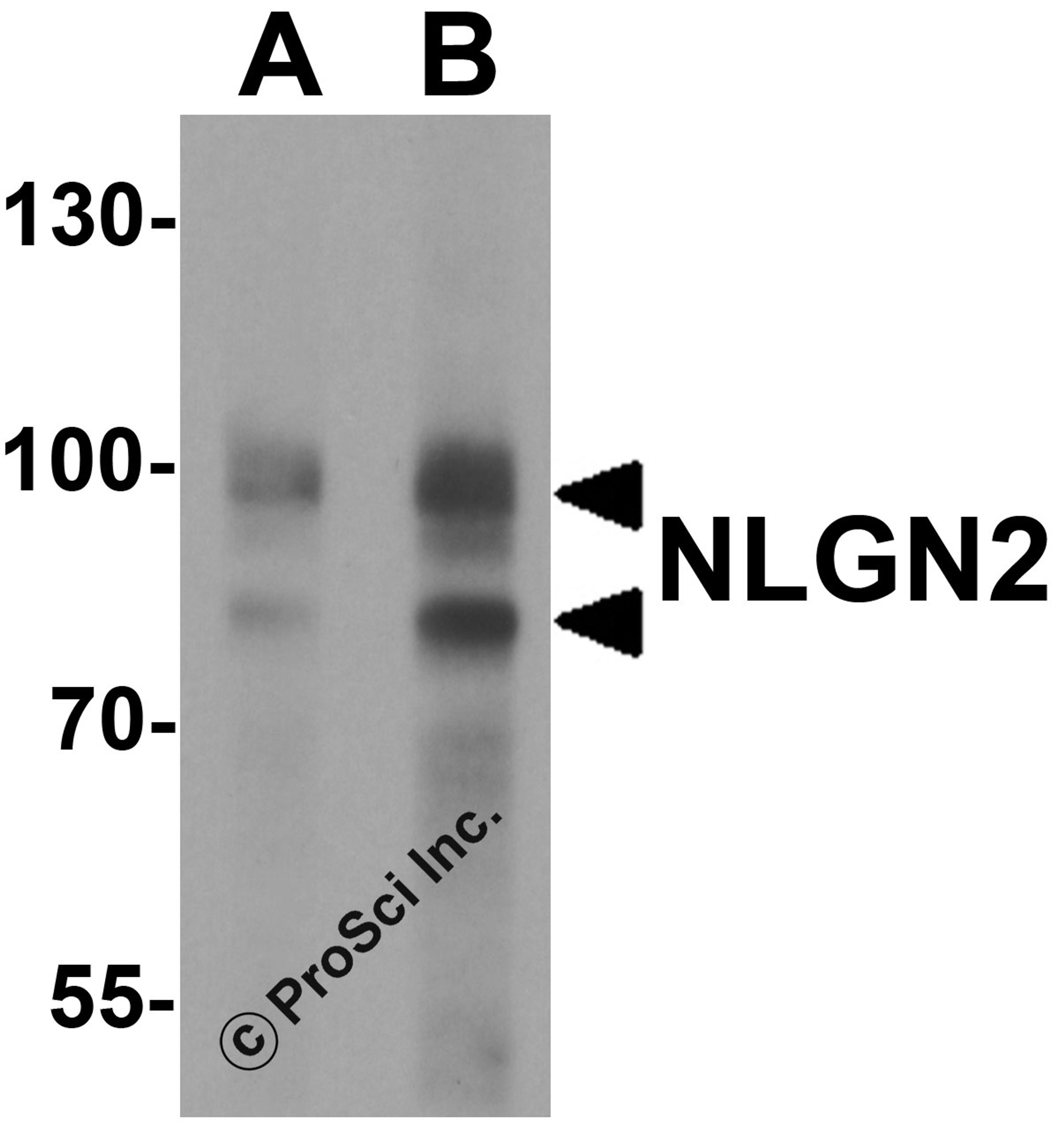 Western blot analysis of NLGN2 in rat brain tissue lysate with NLGN2 antibody at (A) 1 and (B) 2 μg/ml.