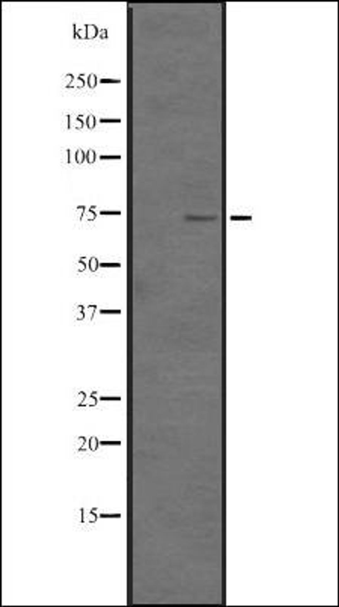 Western blot analysis of HEK293 cells using TNF18 antibody