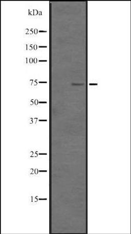 Western blot analysis of HEK293 cells using TNF18 antibody