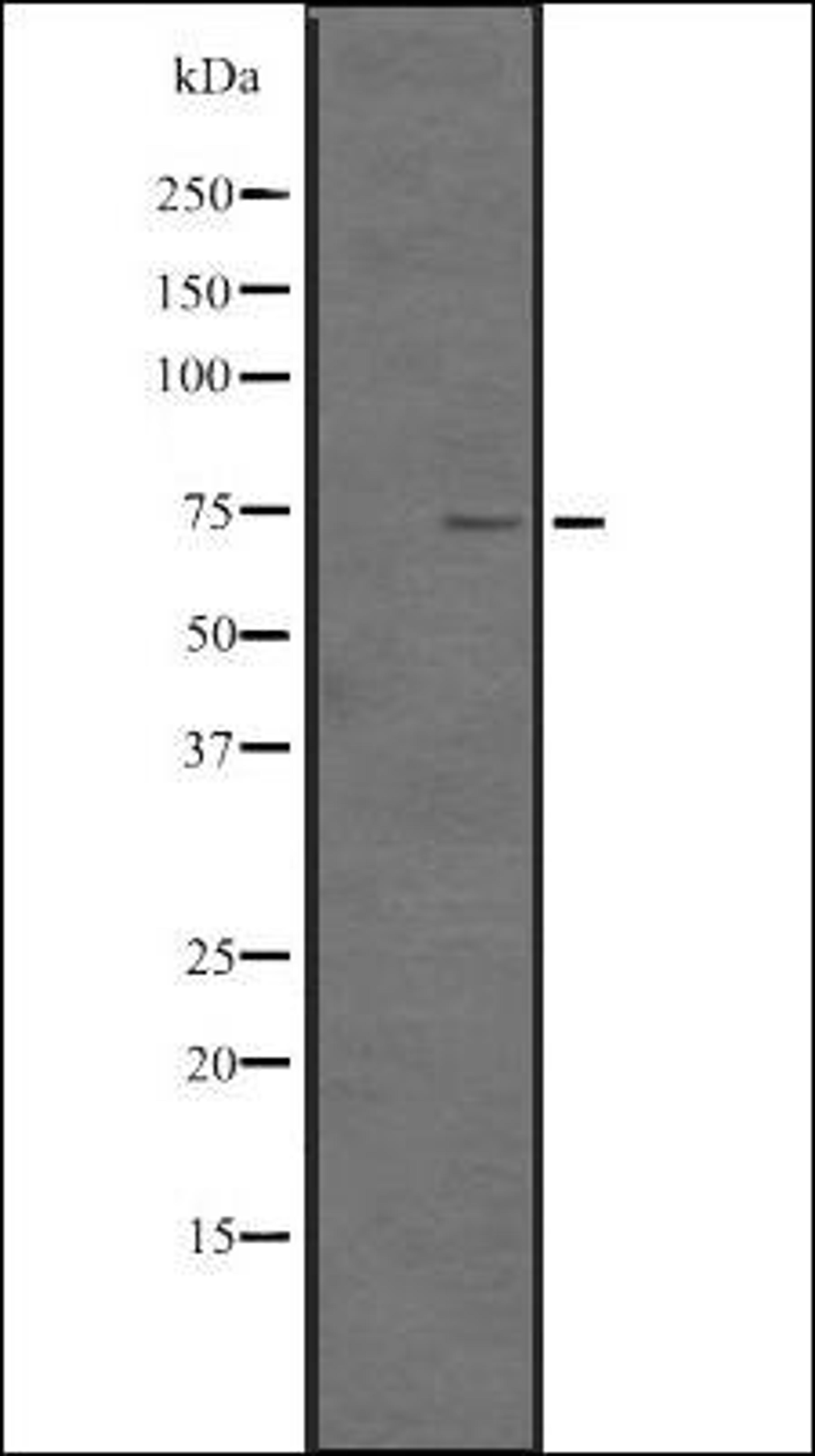 Western blot analysis of HEK293 cells using TNF18 antibody