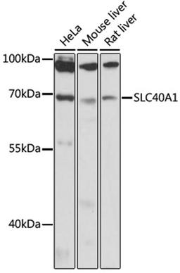 Western blot - SLC40A1 antibody (A14884)