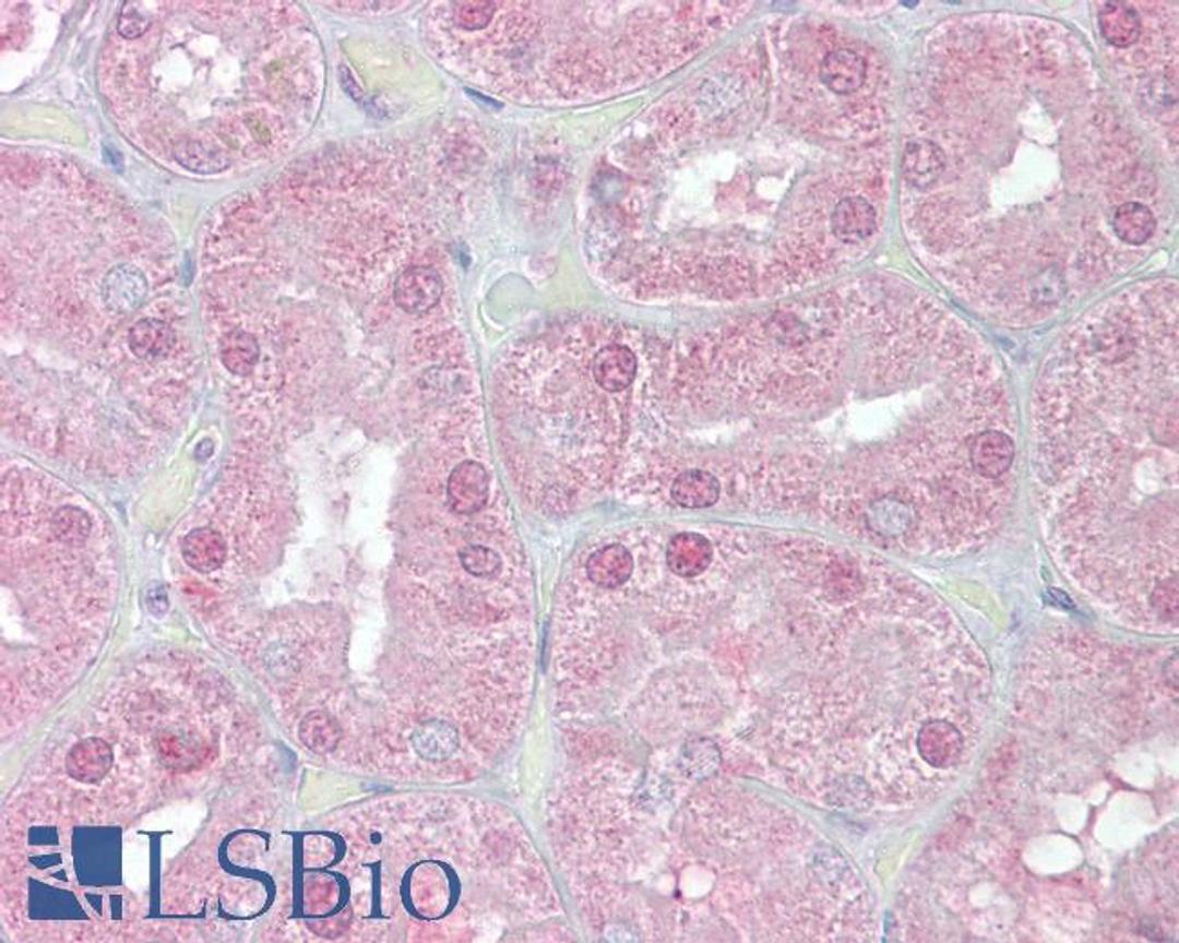 45-606 (2.5ug/ml) staining of paraffin embedded Human Kidney. Steamed antigen retrieval with citrate buffer pH 6, AP-staining.