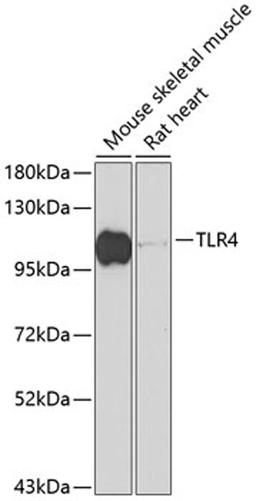 Western blot - TLR4 antibody (A11226)