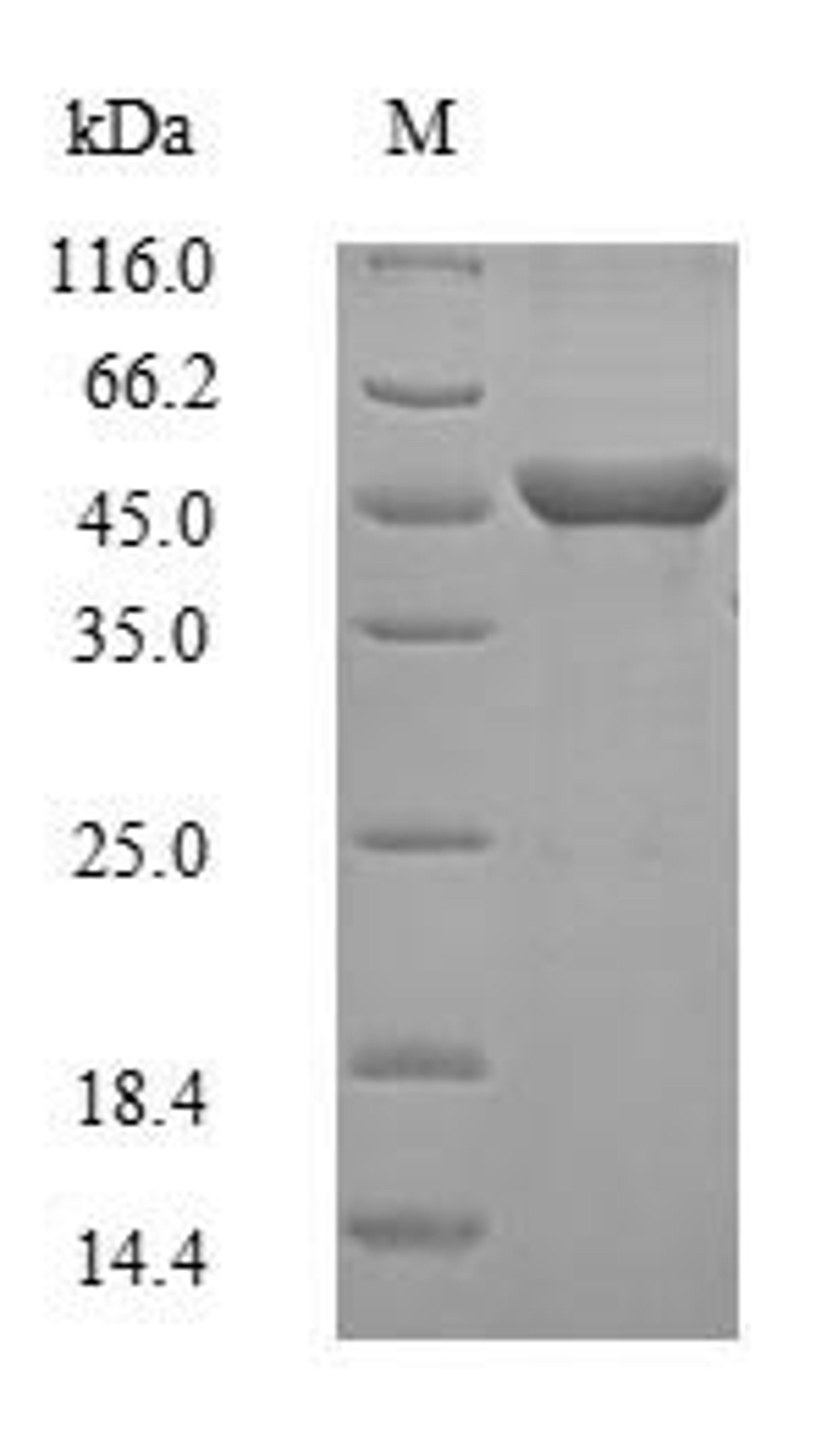 (Tris-Glycine gel) Discontinuous SDS-PAGE (reduced) with 5% enrichment gel and 15% separation gel.