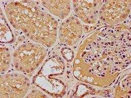 IHC image of CSB-PA008839OA01HU diluted at 1:100 and staining in paraffin-embedded human kidney tissue performed on a Leica BondTM system. After dewaxing and hydration, antigen retrieval was mediated by high pressure in a citrate buffer (pH 6.0). Section was blocked with 10% normal goat serum 30min at RT. Then primary antibody (1% BSA) was incubated at 4°C overnight. The primary is detected by a biotinylated secondary antibody and visualized using an HRP conjugated SP system.