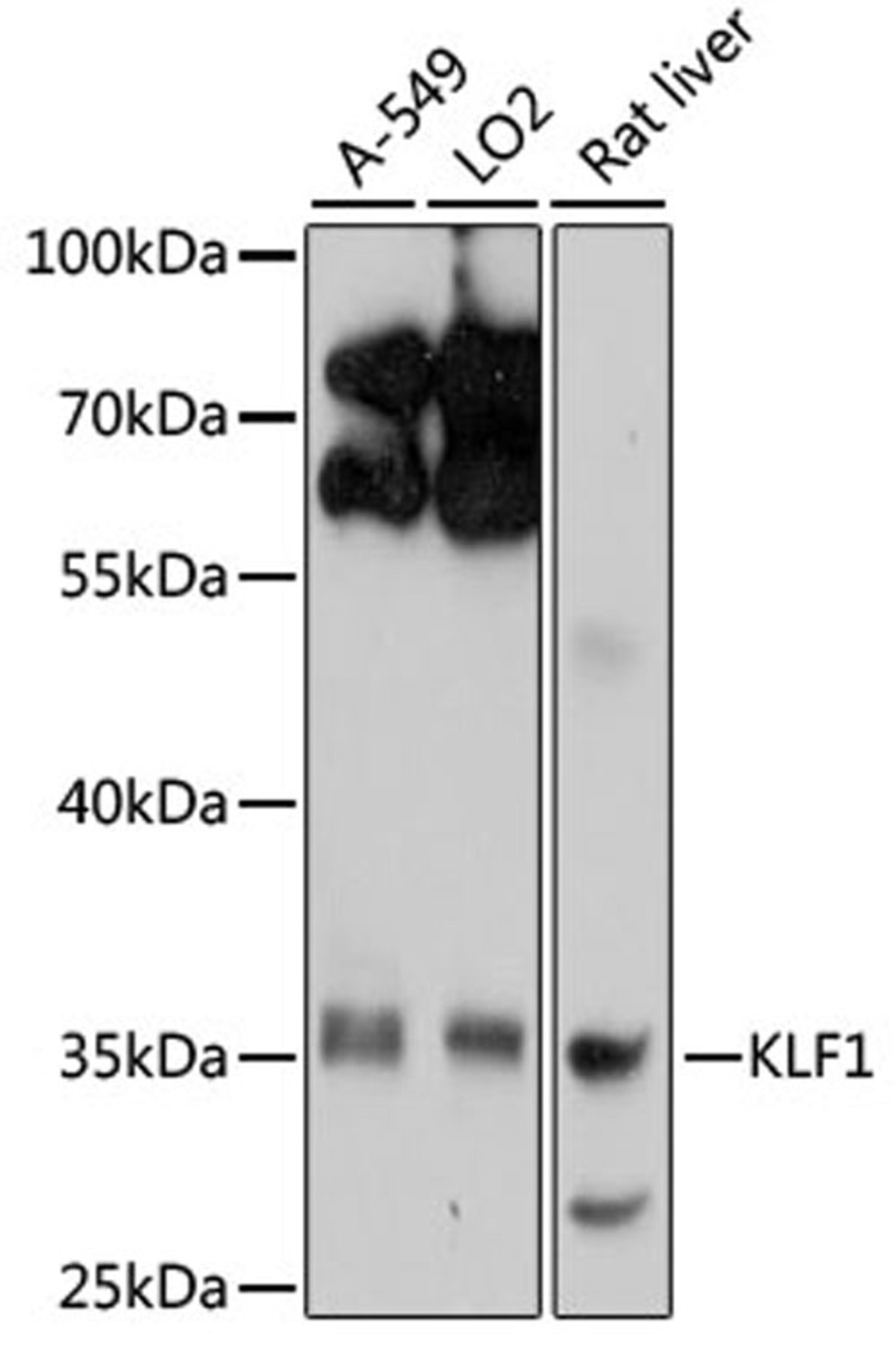 Western blot - KLF1 antibody (A10581)